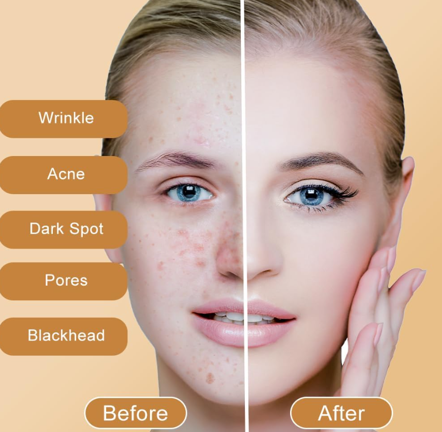 Pure Kojic Acid Skin Brightening Soap,100g Soap Bar for Deep Facial & Body Skin Cleaning with A Foaming Net, Face and Body Bar for Skin Moisturizing, Improve Uneven Skin Tone, Gently Healing Acnes